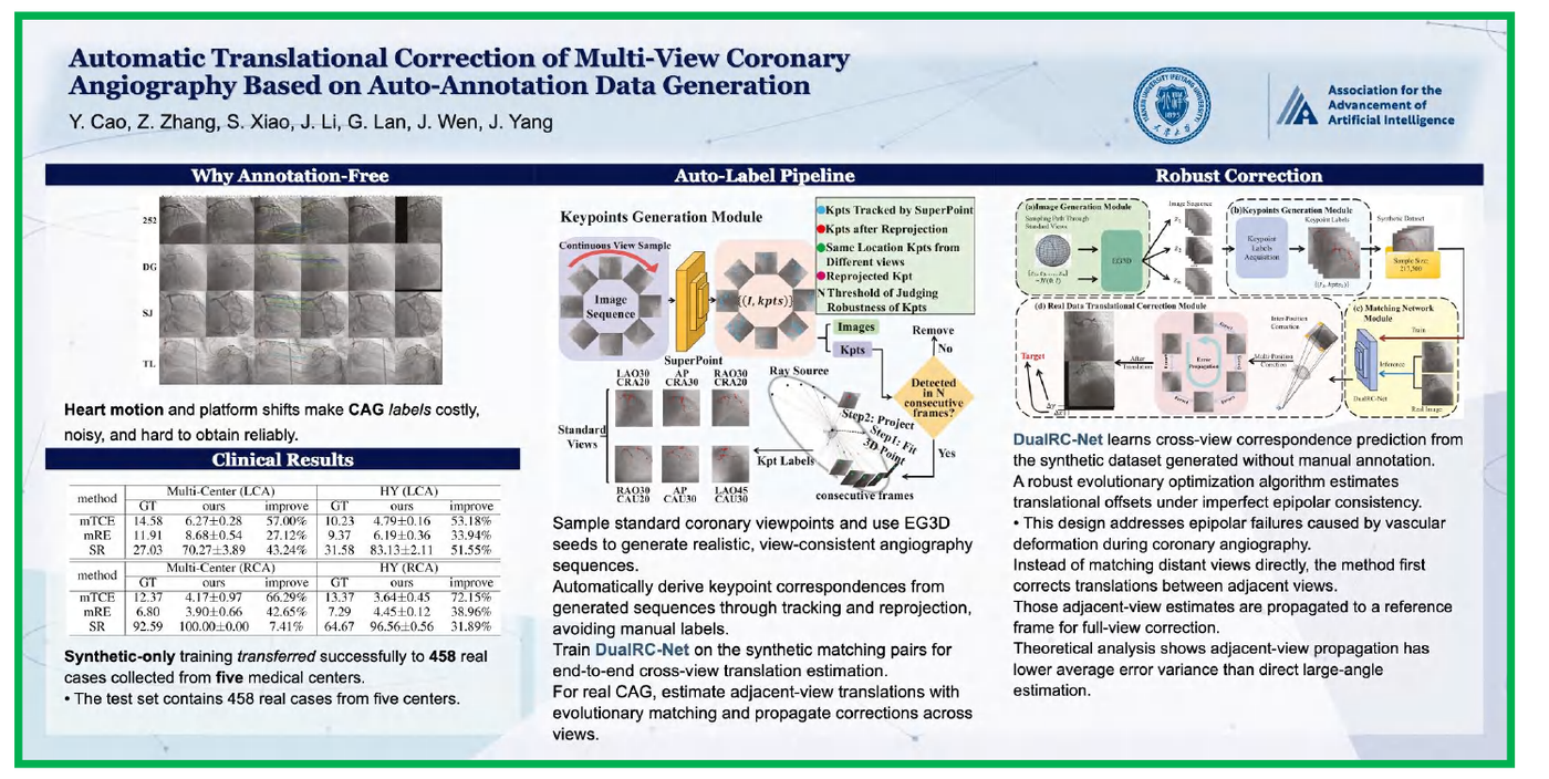 PosterMELD poster for coronary angiography translation correction